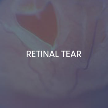 Retinal Tear Treatment Specialist Near Me in New Haven CT, Hamden CT, Madison CT, Trumbull CT, Norwalk CT, and Fairfield, CT Retinal Tear Treatment Specialist Near Me in New Haven CT, Hamden CT, Madison CT, Trumbull CT, Norwalk CT, and Fairfield, CT