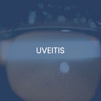 Uveitis Treatment Specialist Near Me in New Haven CT, Hamden CT, Madison CT, Trumbull CT, Norwalk CT, and Fairfield, CT Uveitis Treatment Specialist Near Me in New Haven CT, Hamden CT, Madison CT, Trumbull CT, Norwalk CT, and Fairfield, CT