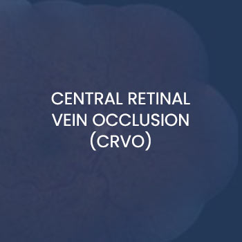 Central Retinal Vein Occlusion (CRVO) Specialist Near Me in New Haven CT, Hamden CT, Madison CT, Trumbull CT, Norwalk CT, and Fairfield, CT Central Retinal Vein Occlusion (CRVO) Specialist Near Me in New Haven CT, Hamden CT, Madison CT, Trumbull CT, Norwalk CT, and Fairfield, CT