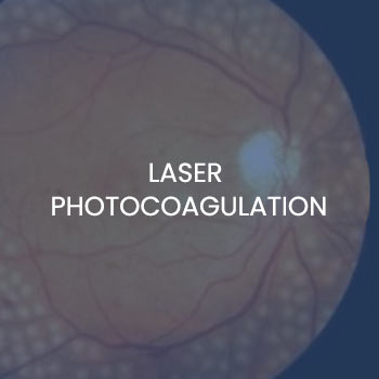 Laser Photocoagulation Near Me in New Haven CT, Hamden CT, Madison CT, Trumbull CT, Norwalk CT, and Fairfield, CT Laser Photocoagulation Near Me in New Haven CT, Hamden CT, Madison CT, Trumbull CT, Norwalk CT, and Fairfield, CT